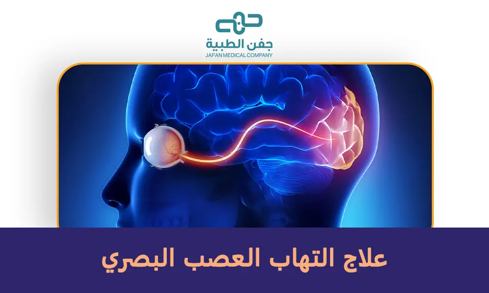 علاج التهاب العصب البصري