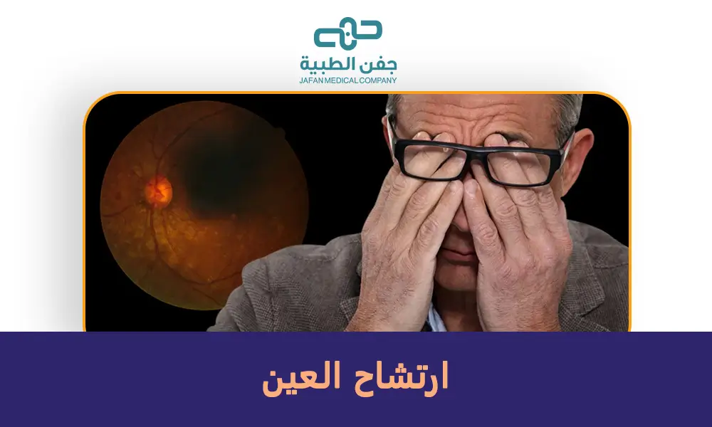 ارتشاح العين